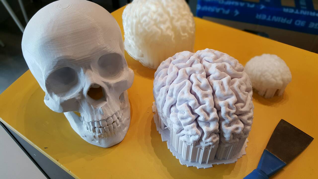 You are currently viewing 3D Print สมอง และกระโหลก เพื่อทำการวิจัยทางการแพทย์