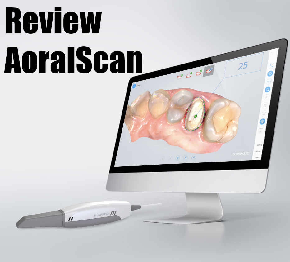 You are currently viewing รีวิว AoralScan สแกนเนอร์ทันตกรรม 3D ในช่องปาก