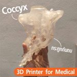 Read more about the article 3D Printing กับ วงการแพทย์ และกระดูกก้นกบ