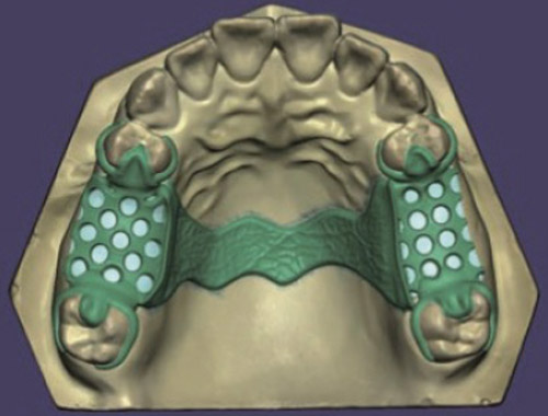 DS-EX Pro/Pro C Dental Model Scanner เครื่องสแกนเนอร์โมเดลฟัน ละเอียดสูง - Image 6